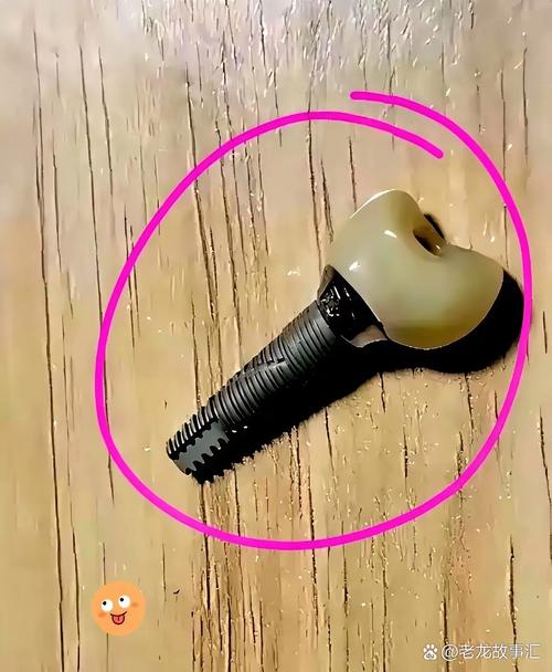 种一颗牙1万2-图2