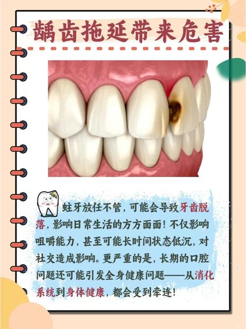 第三种常见牙病是啥？多数人竟忽视！-图2