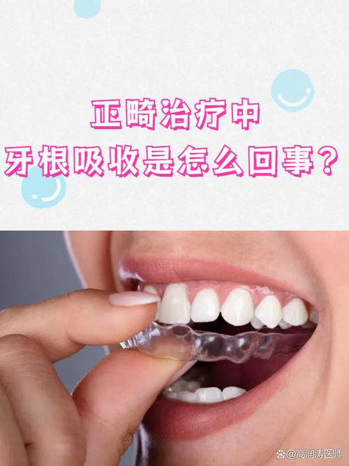 正畸牙根吸收怎么办？处理方法有哪些？-图1