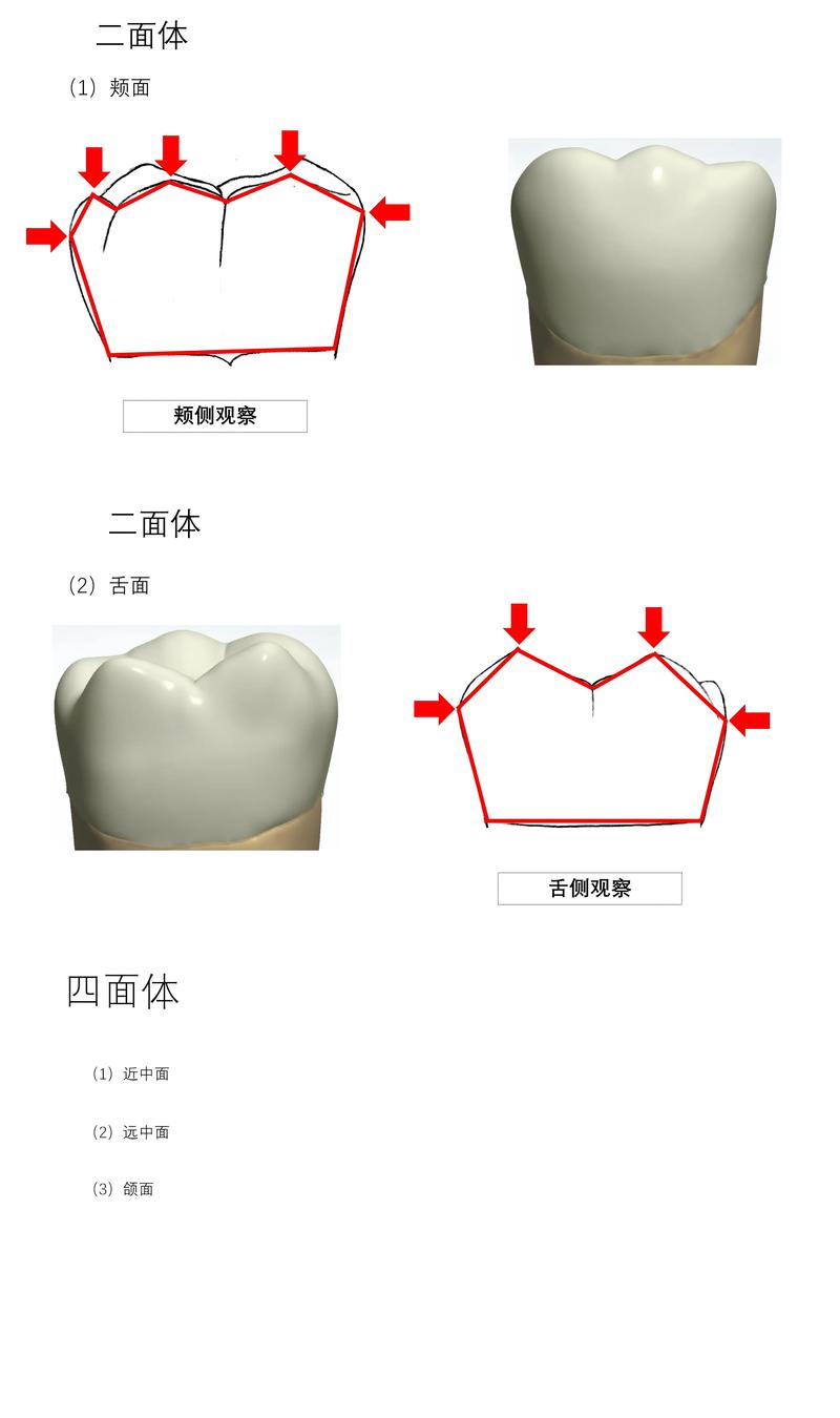 蜡雕牙的方法-图1
