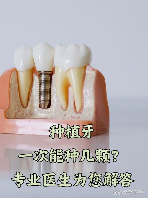 种牙能用一生吗？终身耐用还是需更换？-图3