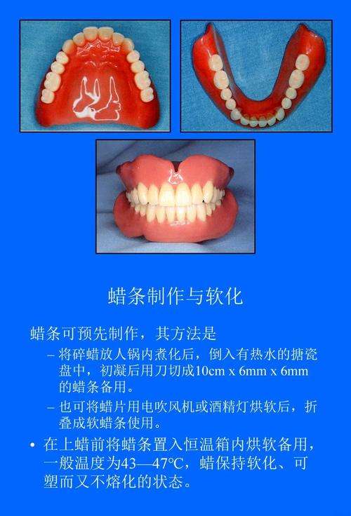 胶托排牙方法的具体操作步骤是怎样的？有哪些关键技巧需要掌握？-图3