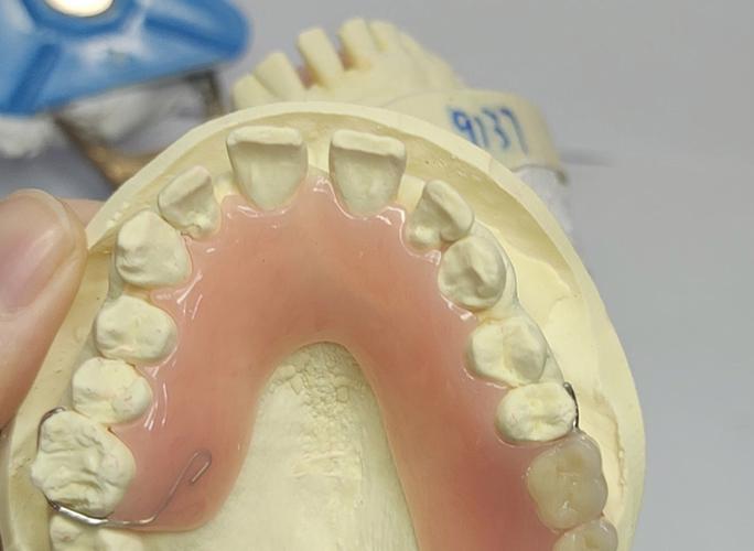 胶托排牙方法的具体操作步骤是怎样的？有哪些关键技巧需要掌握？-图1