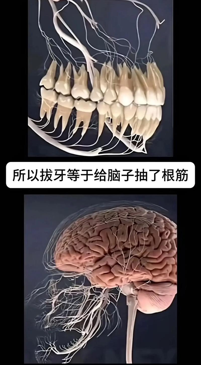 拔牙一年不种牙-图3