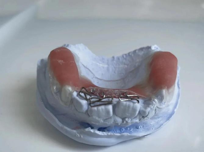 正畸双曲舌簧弯制方法的核心要点是什么？-图1