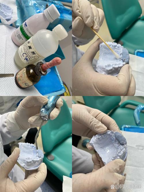 正畸双曲舌簧弯制方法的核心要点是什么？-图3