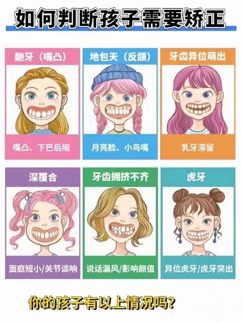 正畸2乘4技术适用于哪些错颌畸形？-图1