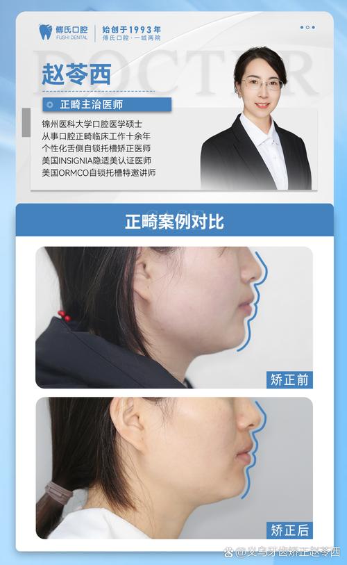 颏唇沟过深正畸有用吗-图1