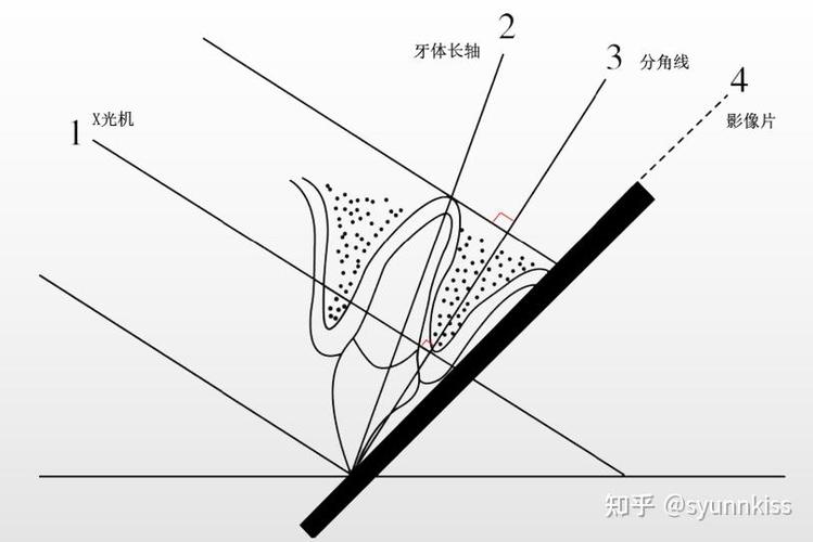 牙科摄片方法-图2 牙科摄片方法-图2
