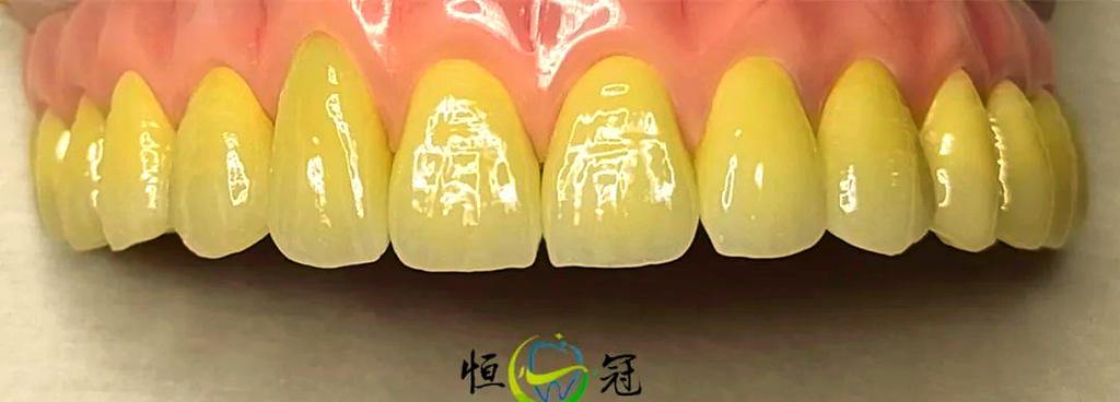 牙体抛光方法-图2 牙体抛光方法-图2