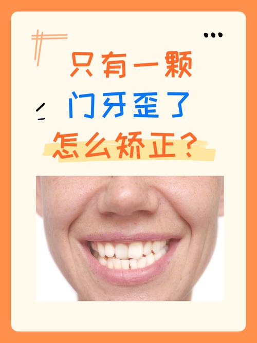 门牙牙根短，正畸矫正可行吗？-图3