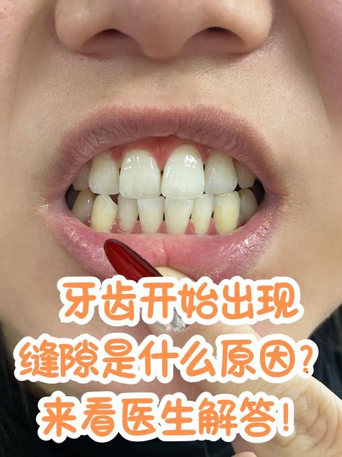 牙缝变小方法-图2