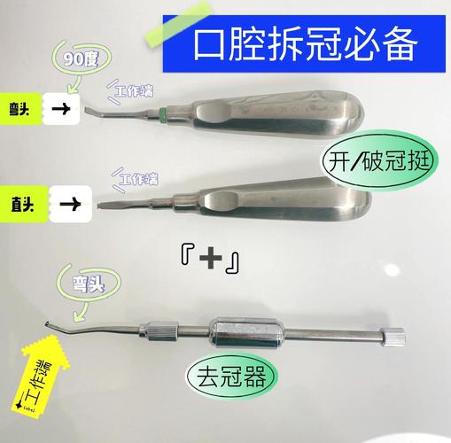 冠修复的方法-图3