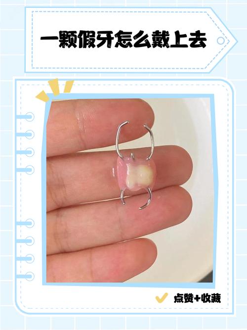 假牙取戴的正确方法与步骤是怎样的？-图1