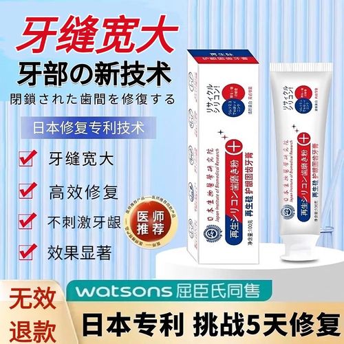 补门牙缝有哪些方法？哪种最适合自己？-图3