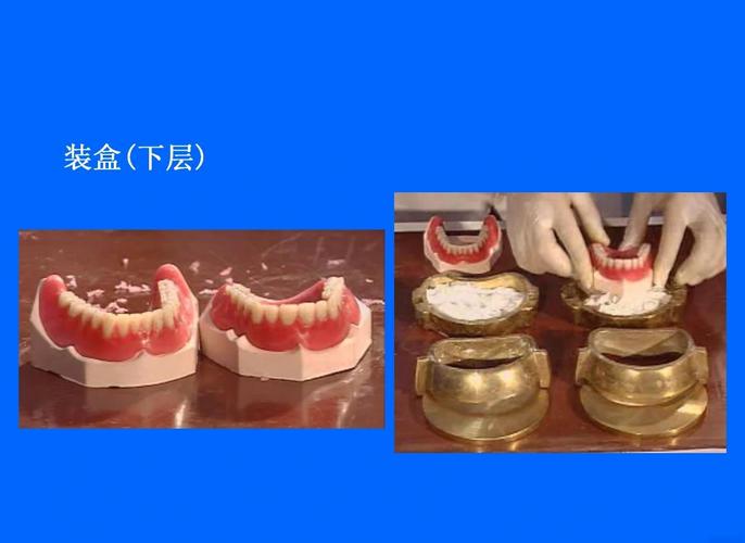 口腔雕牙方法-图1