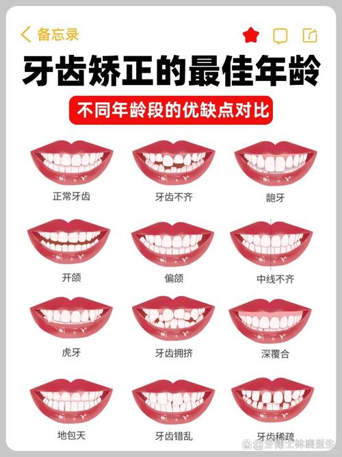 上海牙齿正畸去哪家医院好？靠谱机构怎么选？-图2