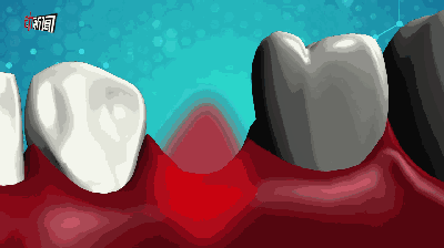 种牙过程动态图-图3 种牙过程动态图-图3