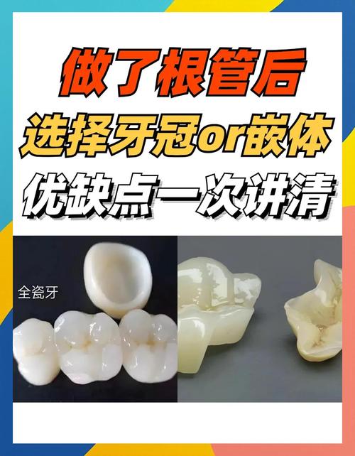 桥冠补牙与种牙有何区别？哪种缺牙修复方式更优？-图1