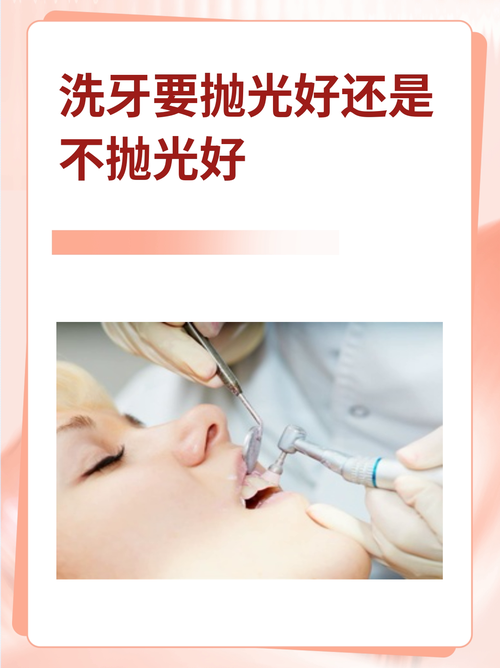 牙面抛光方法-图2