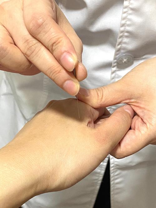 夹针正确方法是什么？操作步骤与技巧详解-图2