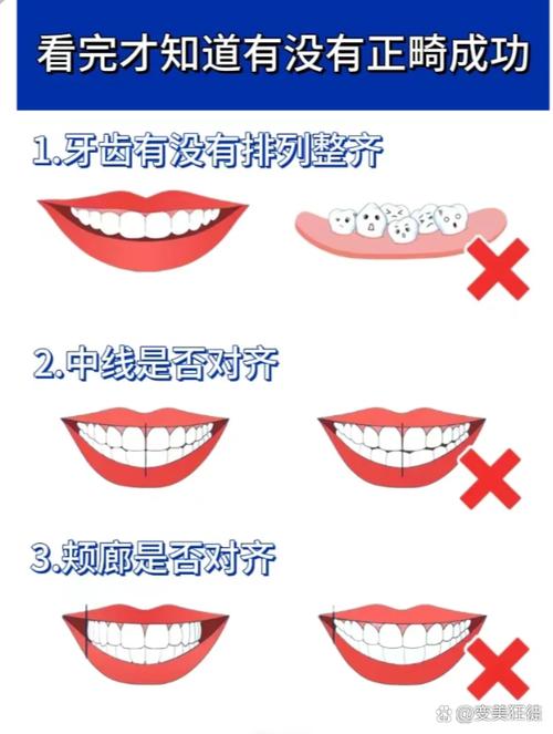牙齿正畸如何有效调整咬合？-图3