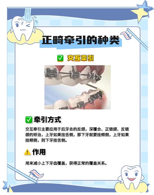 牙周病的正畸治疗特点-图2