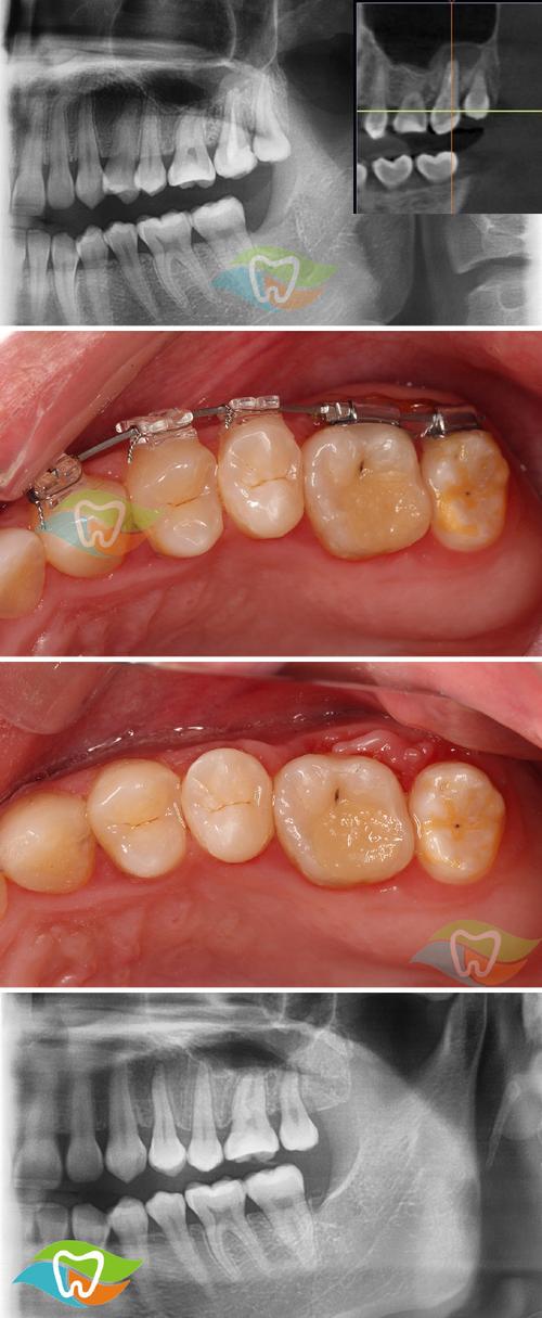 TOMY口腔正畸技术-图2