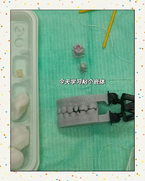 嵌体粘结方法的关键步骤是什么？-图1