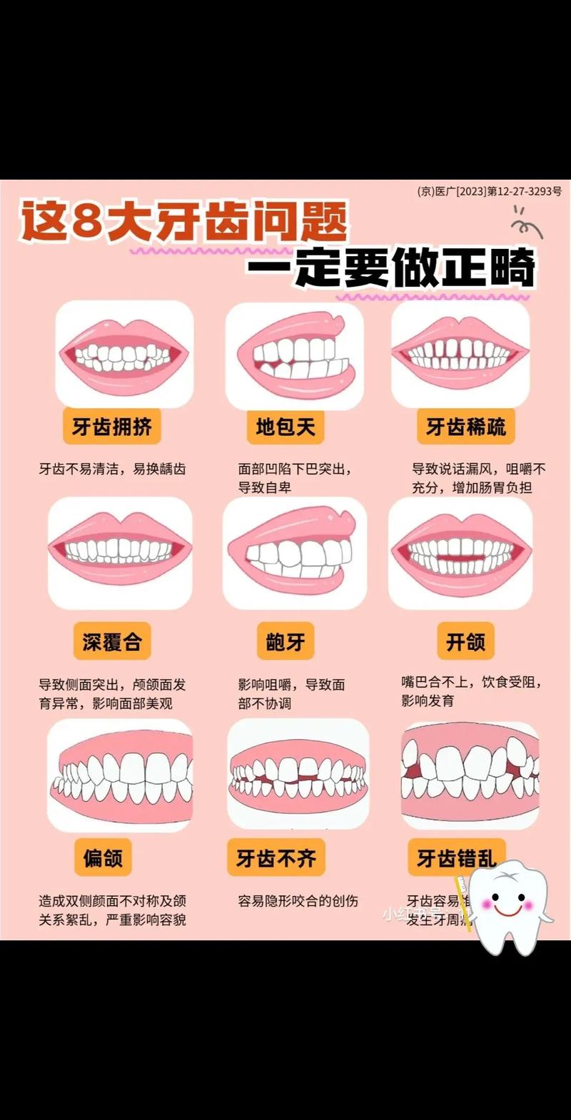 牙齿稀疏怎么办？有效改善方法有哪些？-图2