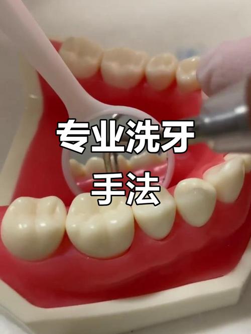 牙科洁牙方法哪种好？日常护理该如何搭配才有效？-图2