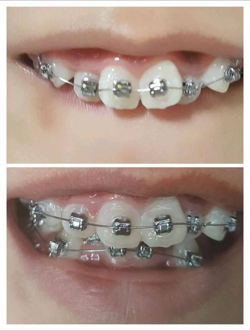 山东省口腔医院 正畸-图2