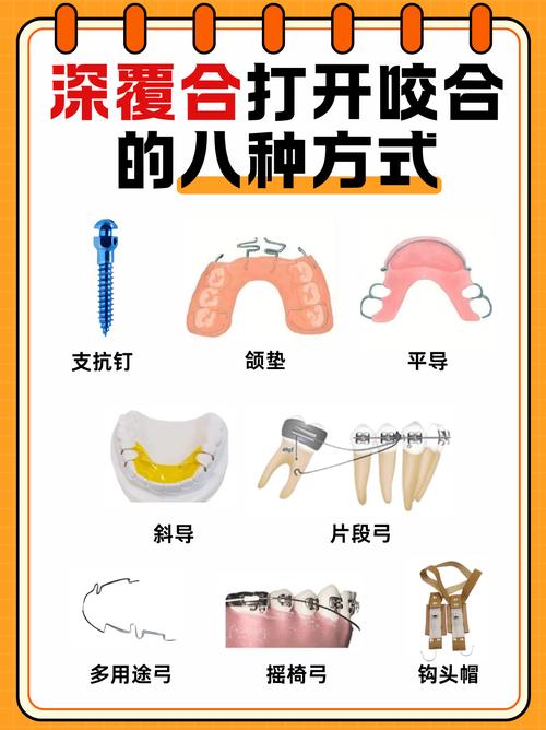 抬高咬合方法-图2 抬高咬合方法-图2