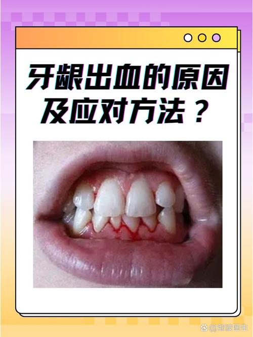 种牙动脉大出血，风险从何而来？如何避免致命伤害？-图2