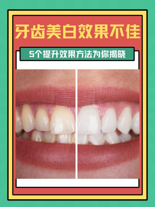 增白牙齿方法-图2