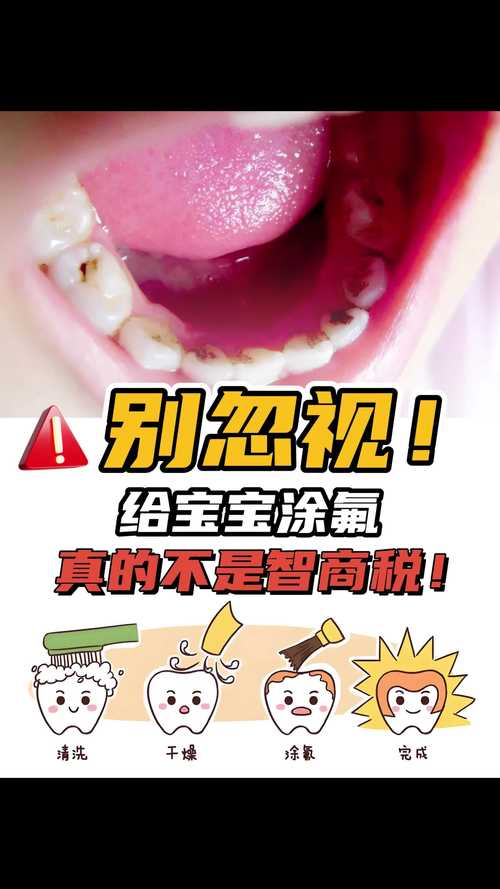 儿童涂氟方法-图3