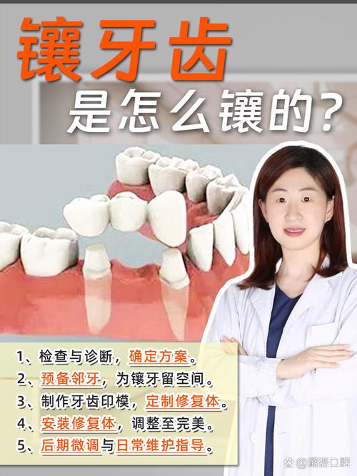 塞牙治疗方法-图3