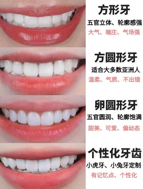 牙齿贴面方法怎么选？哪种更适合自己？-图2