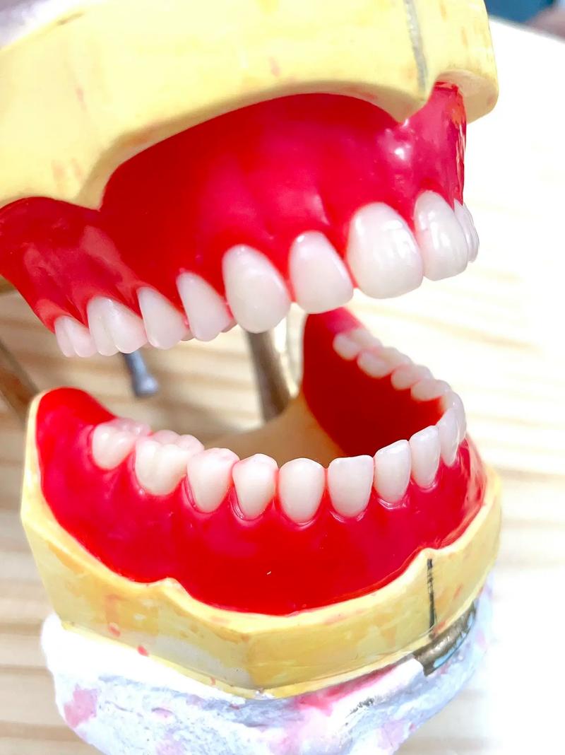 义齿排牙方法-图2