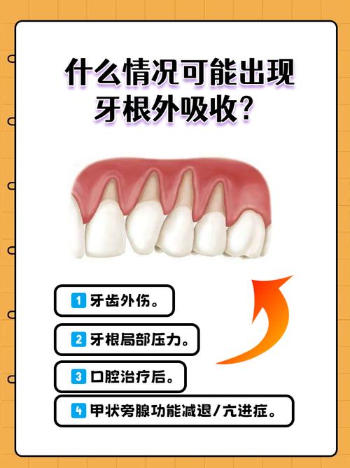 牙根吸收多少不能正畸-图2