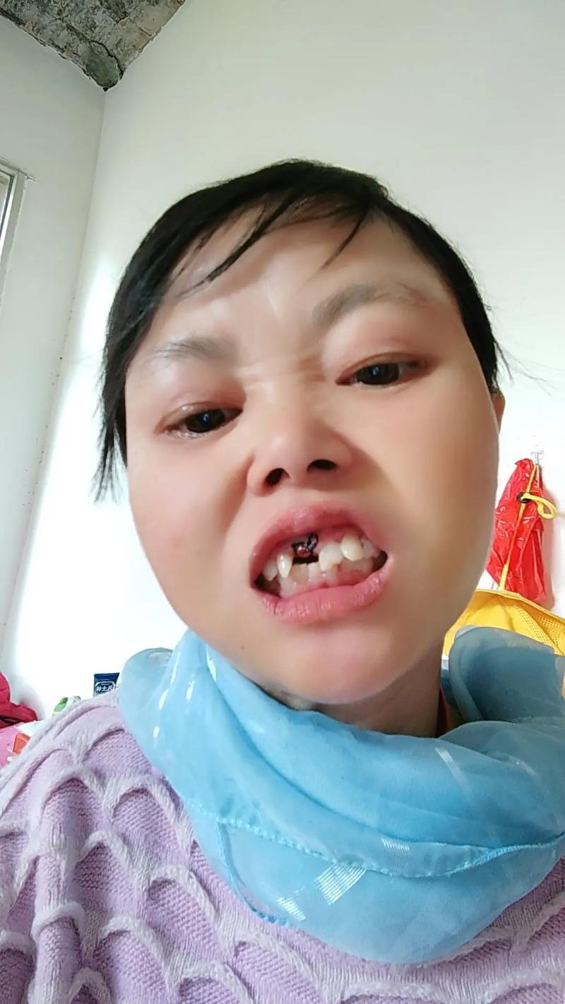 有小孩种牙的吗-图3 有小孩种牙的吗-图3