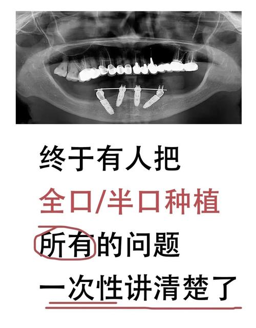 半口牙即种即用-图3