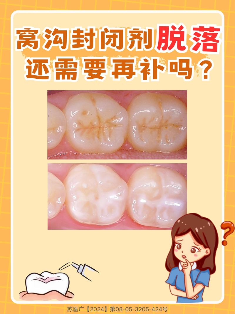 蛀牙修补方法有哪些？如何选择适合自己的修复方式？-图3