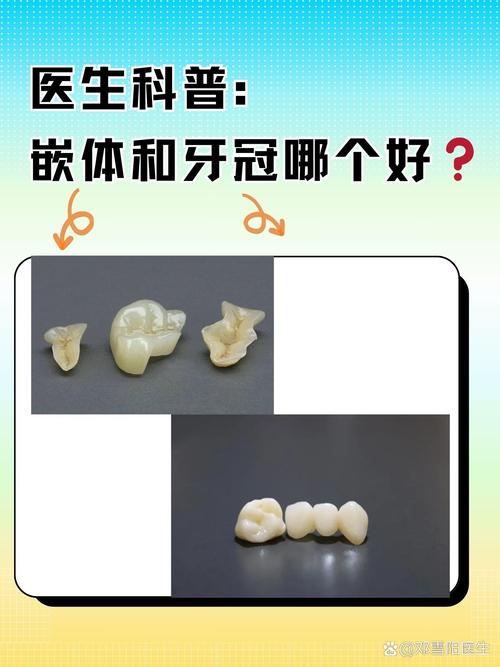 核冠修复和种牙-图3