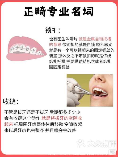 正畸八字结扎方法图解-图1