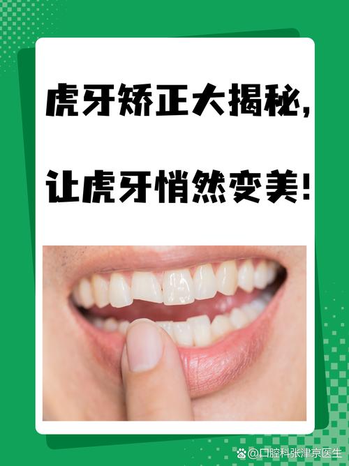 虎牙矫正方法-图3