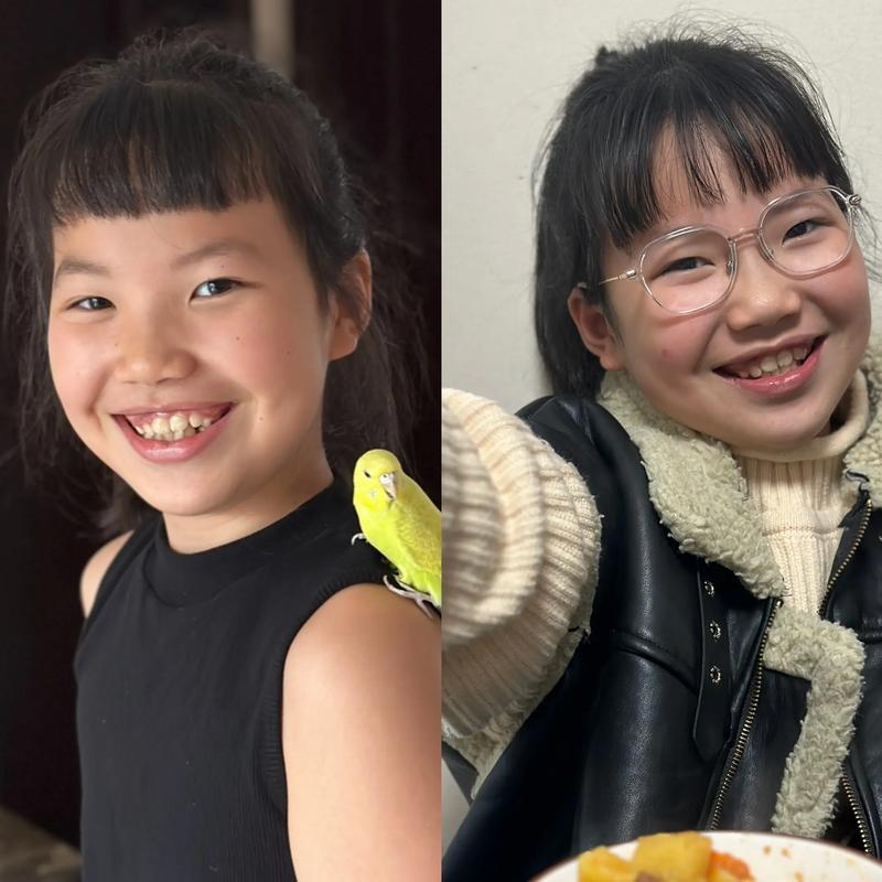 正畸和矫正有何不同？核心区别详解！-图3