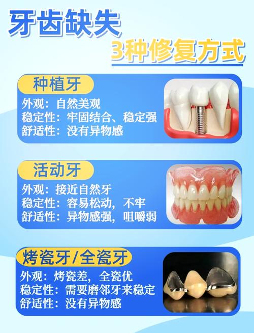 修补牙齿有哪些方法？哪种最适合你？-图1