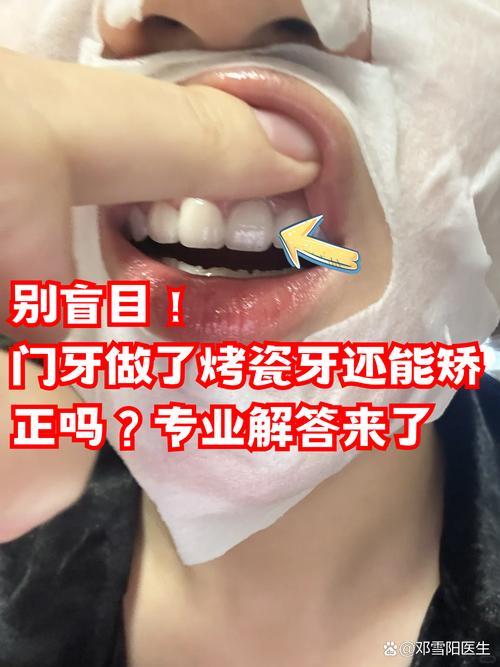 烤瓷牙可不可以正畸-图1