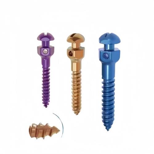 正畸戴大支抗钉三个月，矫正效果究竟如何？-图1